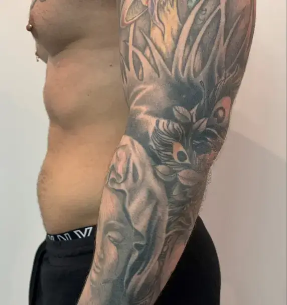 emsculpt (1) - copia