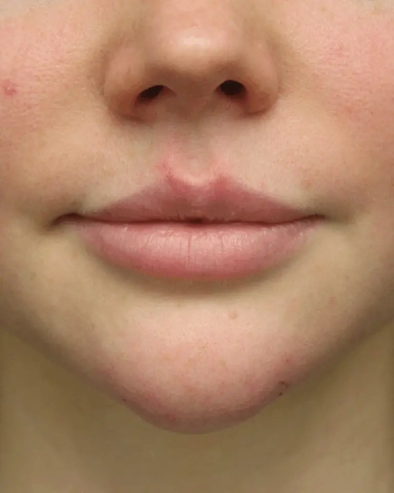 PUBLICACION IG VEQ (4)